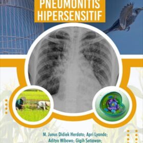 Pneumonitis Hipersensitif